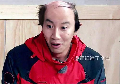 秃头的明星网红,揭秘明星网红的秃头时尚风潮”