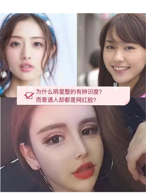 广州明星网红整形,明星同款变美秘籍大揭秘