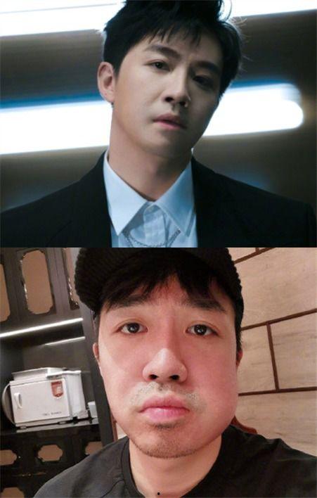 明星网红拔智齿,揭秘明星口腔护理日常