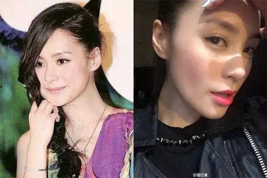 明星网红拔智齿,揭秘明星口腔护理日常